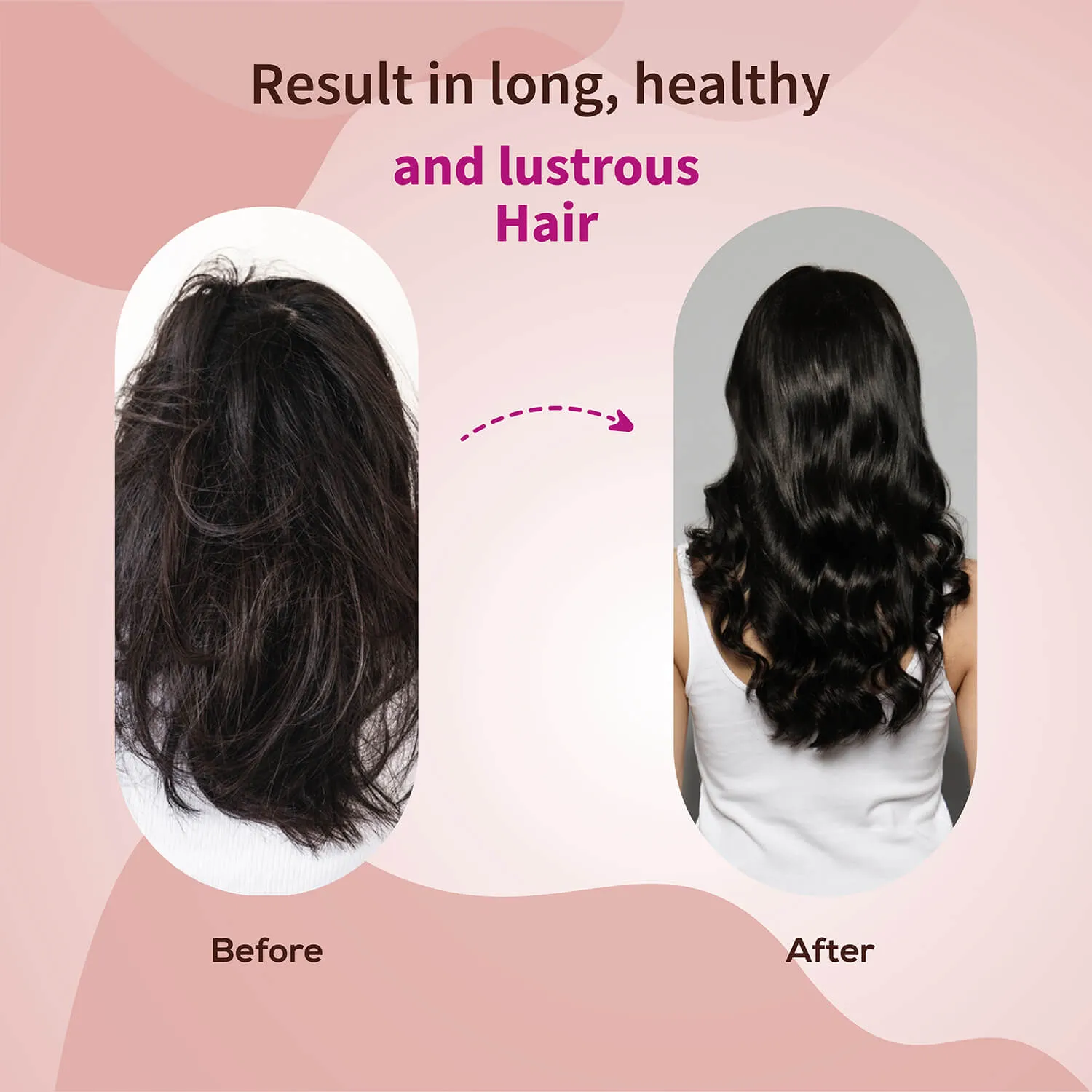 Anti-Hair Fall Shampoo with Onion and Coffee -(Net Qty- 200ml)